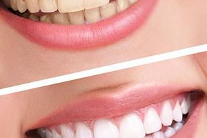 teeth4jpg-57069e8a5f8e9c32610f5798[1]