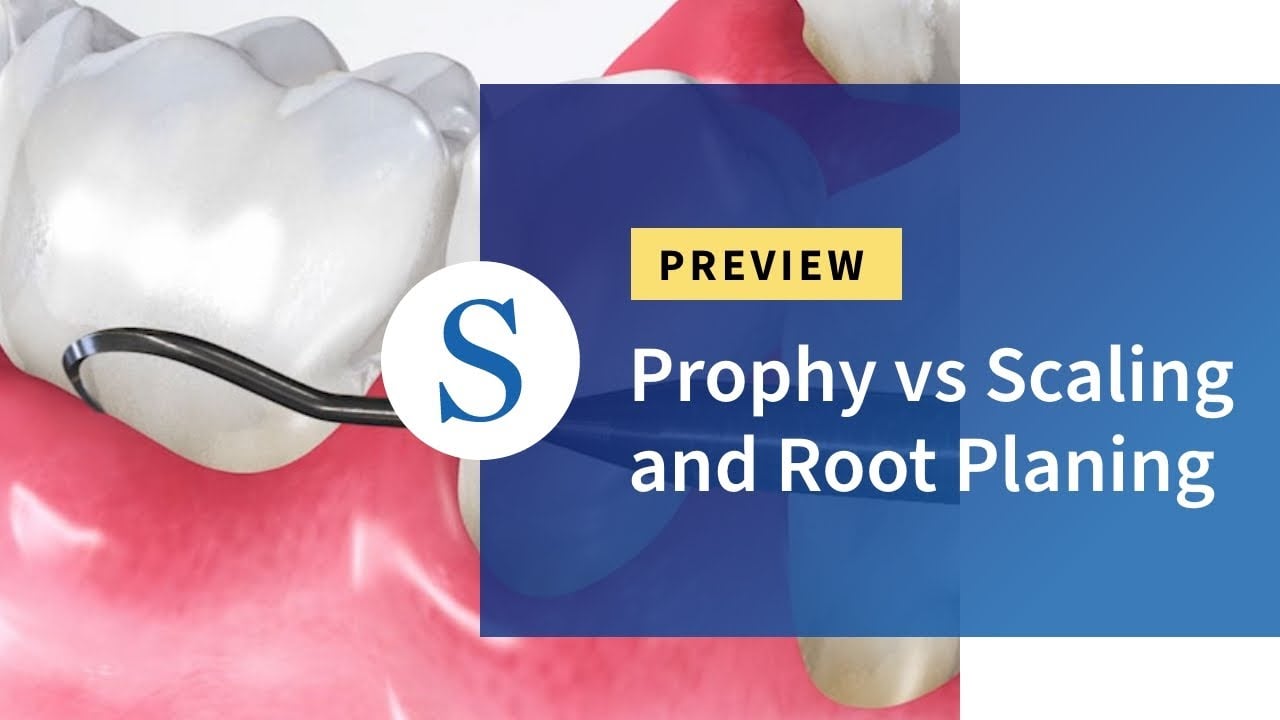 Prophy vs Scaling and Root Planing Video Thumbnail
